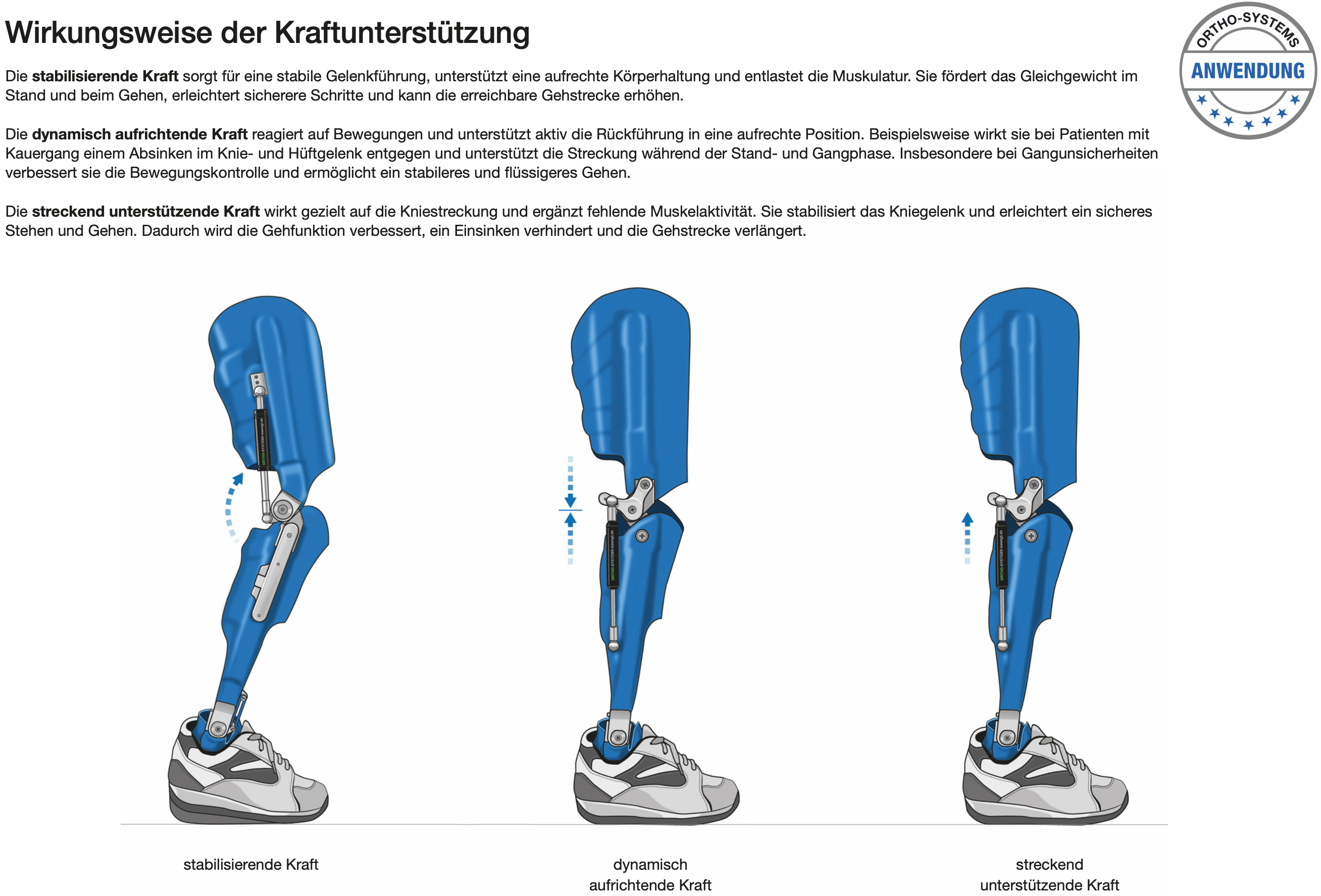 Anwendungsbereiche von Streckhilfen - Bild2