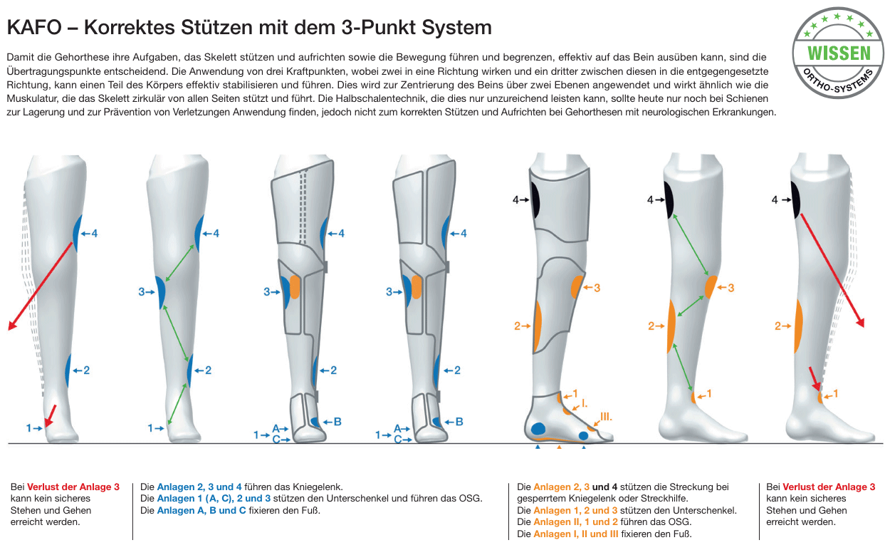 KAFO 3-Punkt System - Bild1