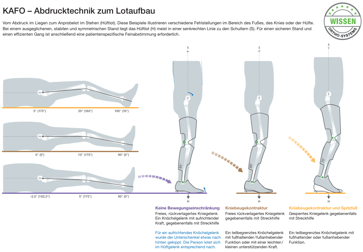 KAFO Abform- und Abdrucktechnik - Bild2