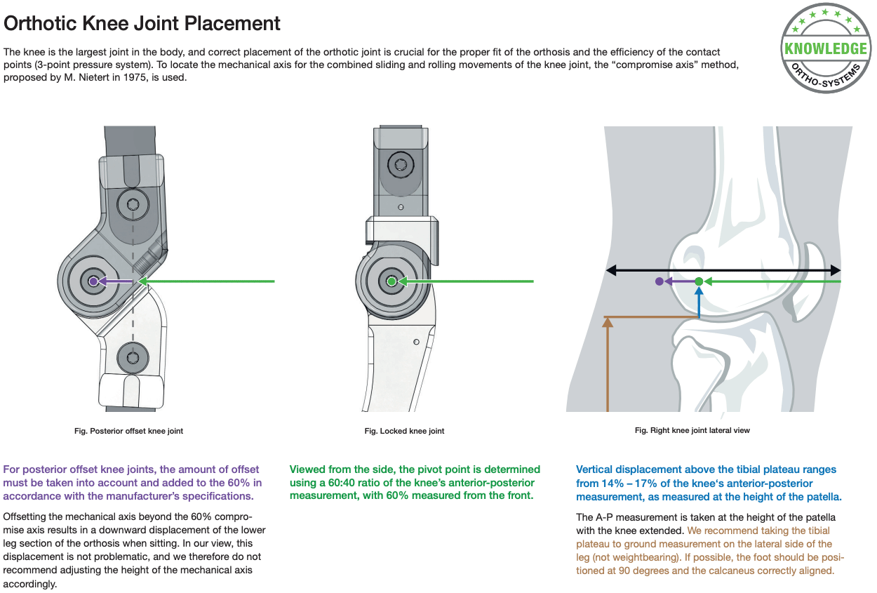Orthotic Joint Placement - Image 2