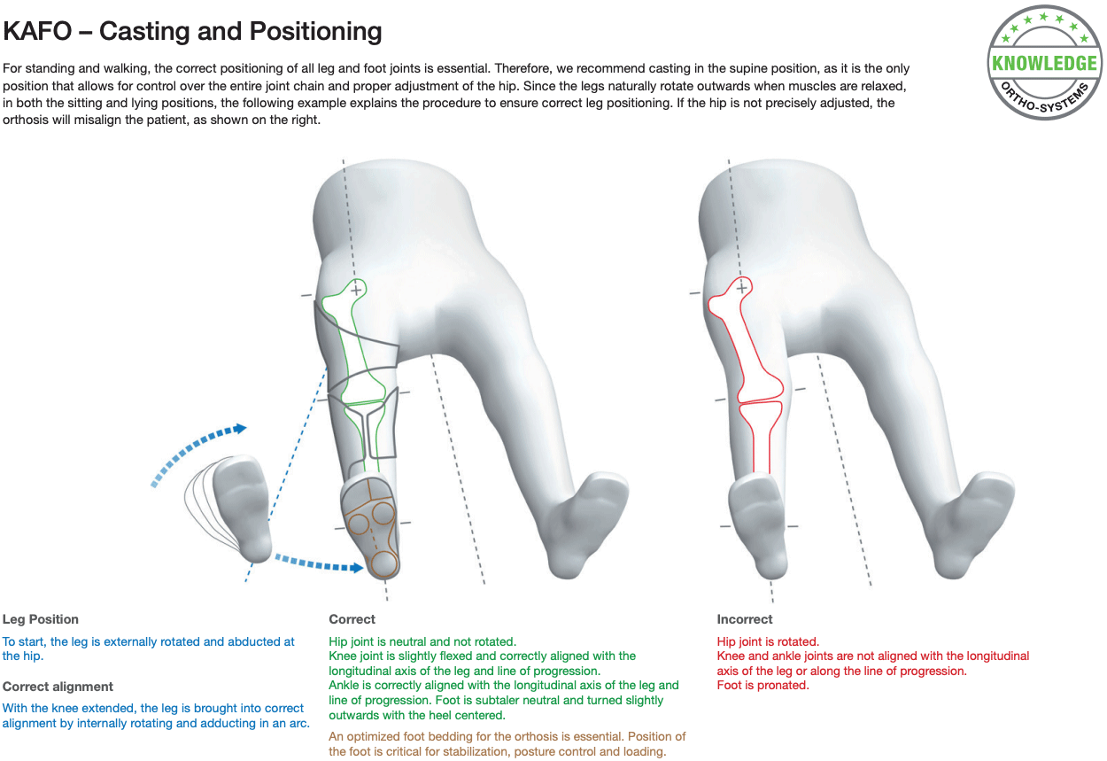 KAFO Casting - Image 1