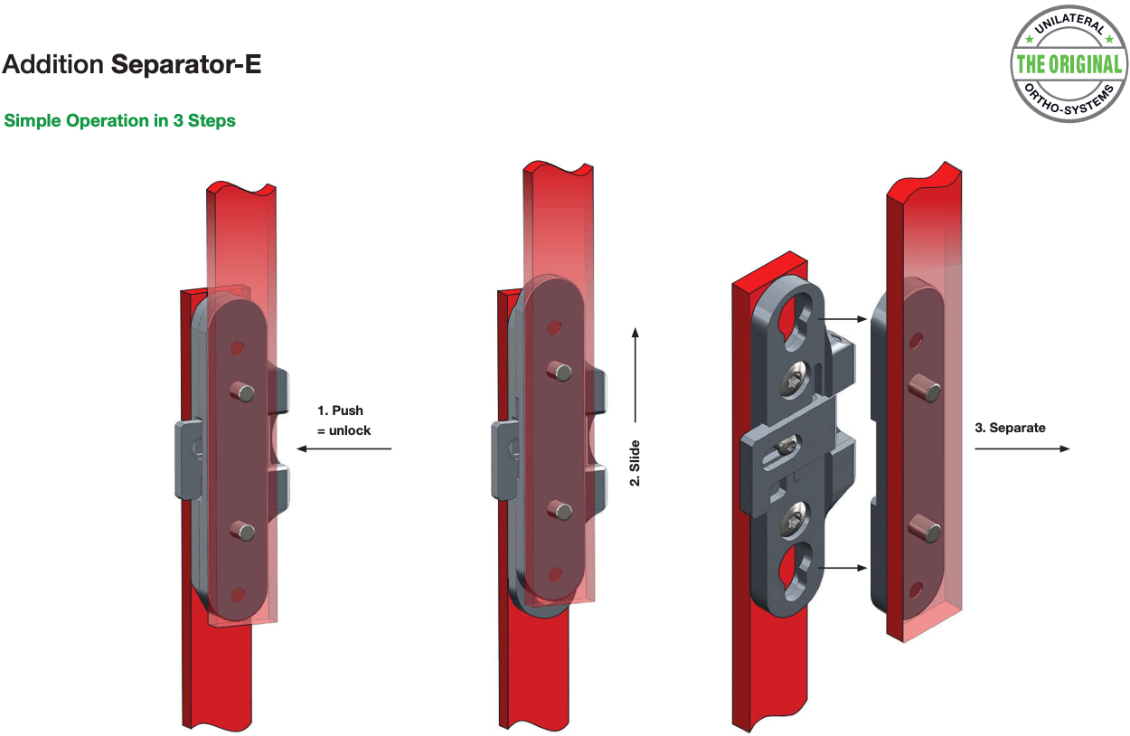 Features of Separator-E