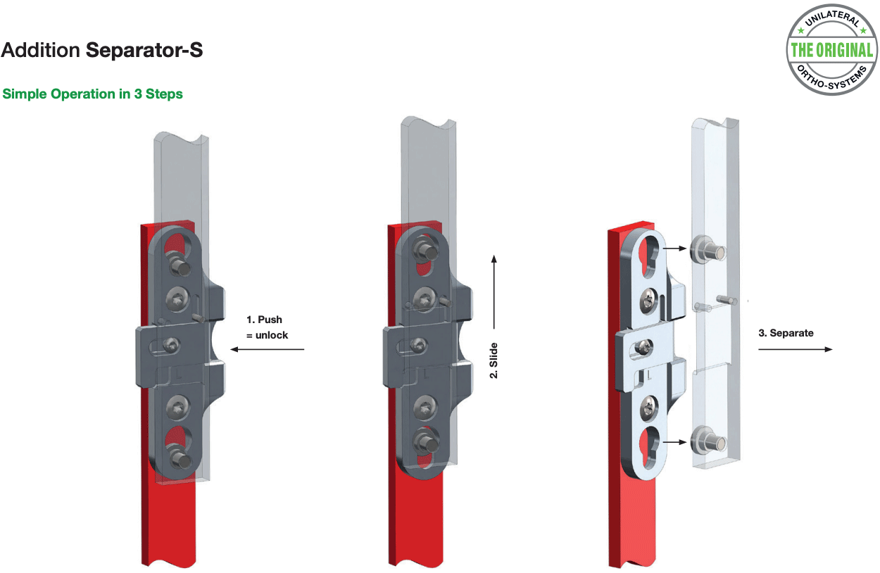 Features of Separator-S